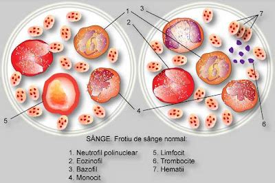 largimea distributiei trombocitare scazuta|PDW crescut si scazut